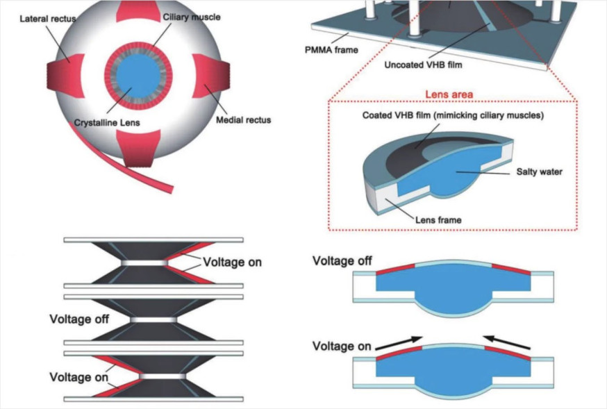 contactlens